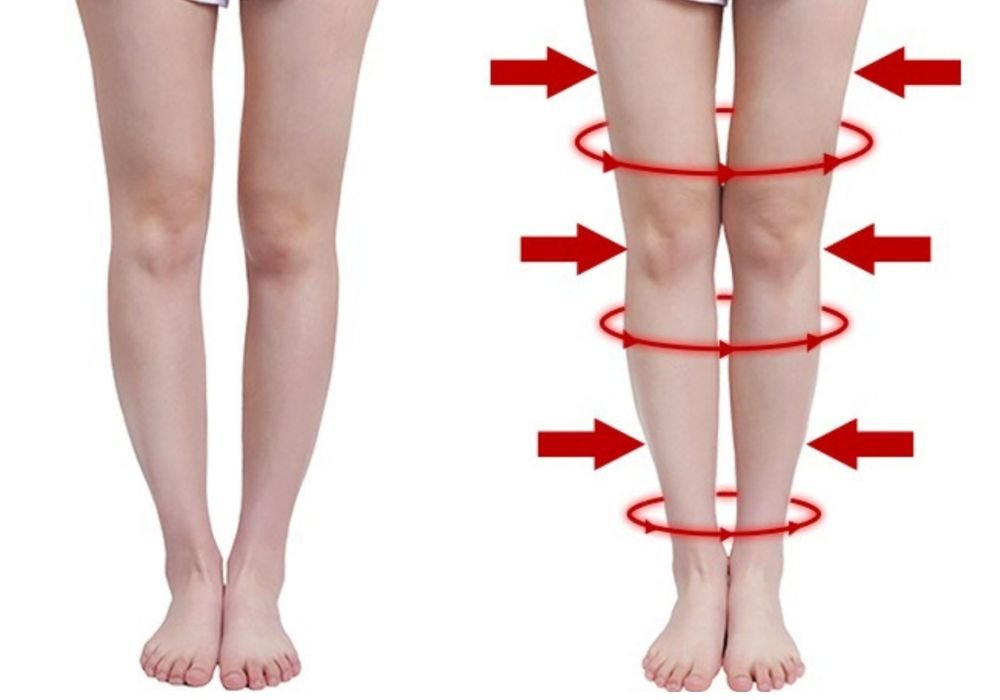 Chân vòng kiềng là gì?