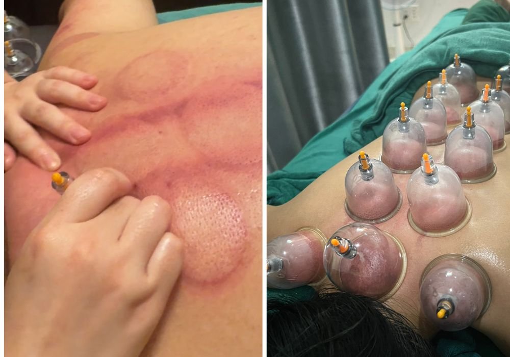 Chi phí cho một liệu trình massage trị liệu là bao nhiêu?