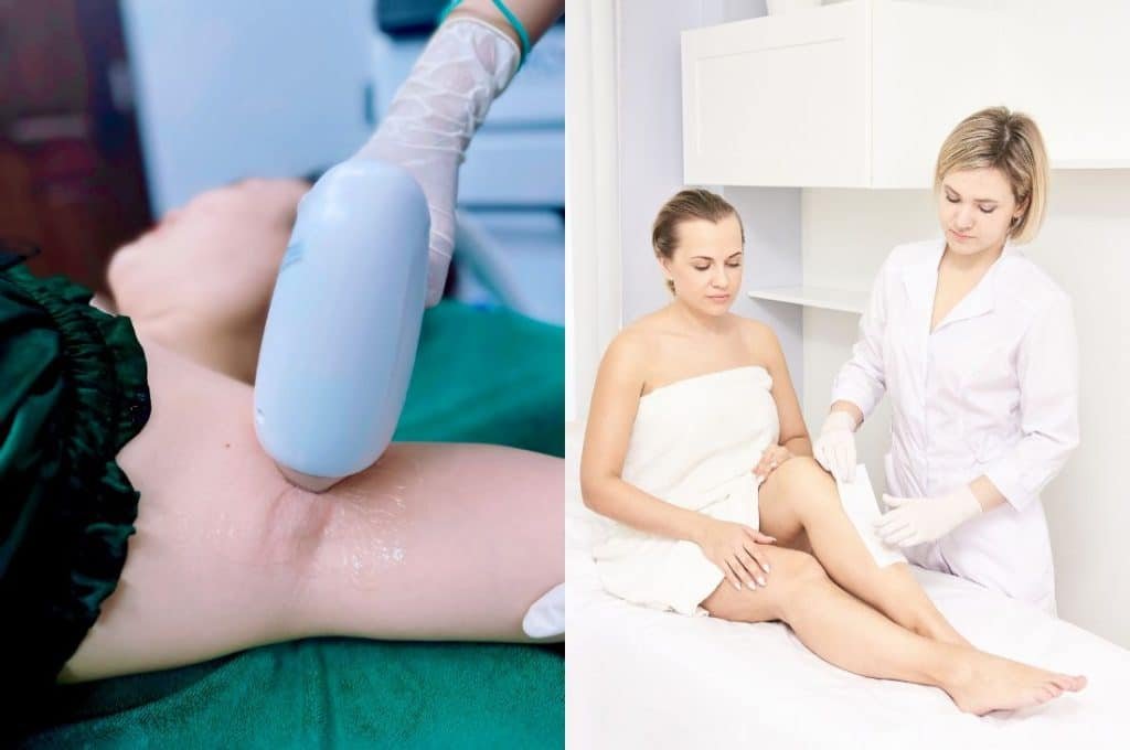 Nên triệt lông, cạo lông hay wax lông sẽ tốt hơn?